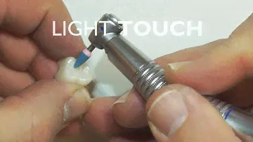 All Ceramic Polisher Intra-Oral Kit